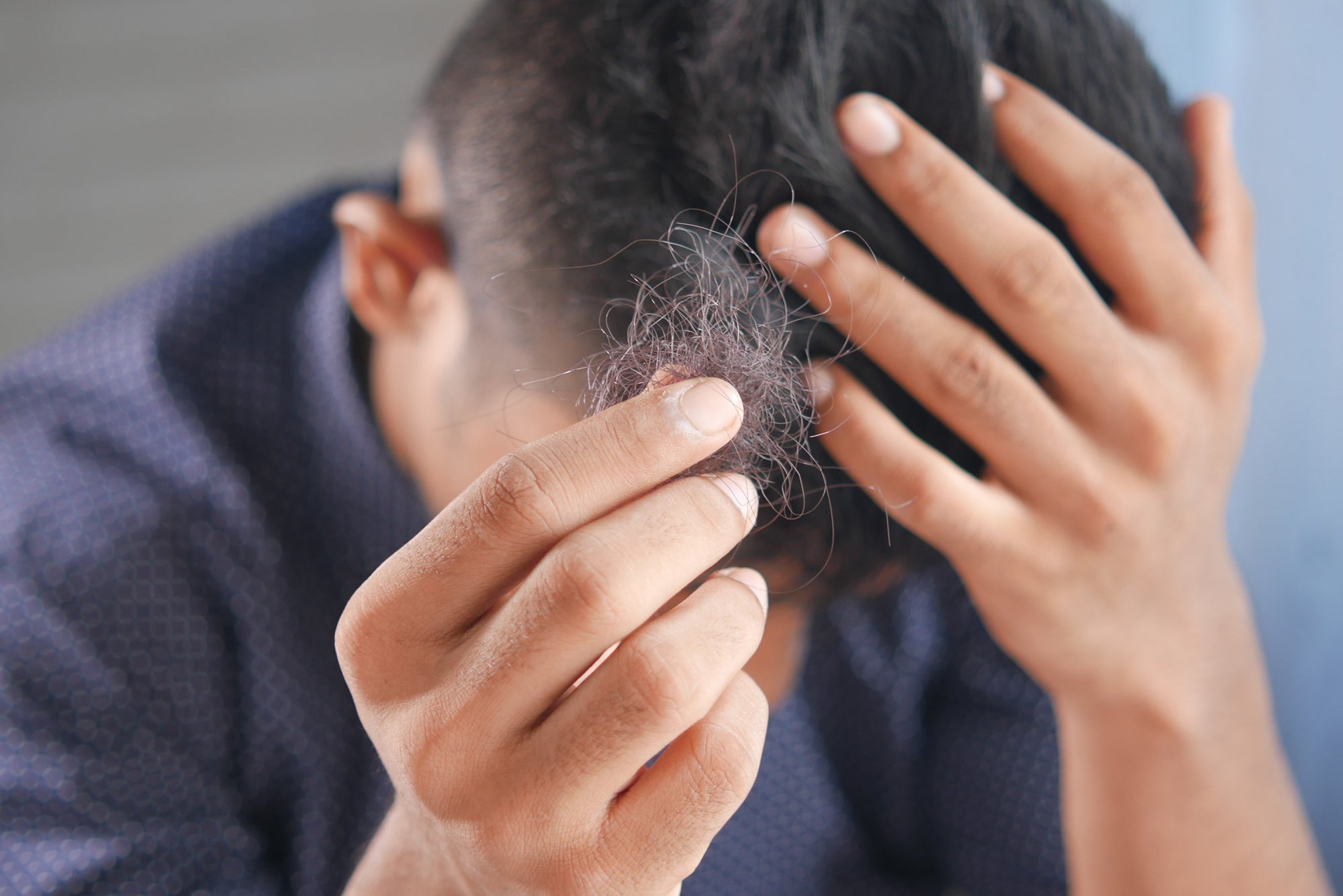 Image of person with thinning hair